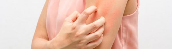 Дупилумаб одобрен Минздравом для лечения атопического дерматита у подростков