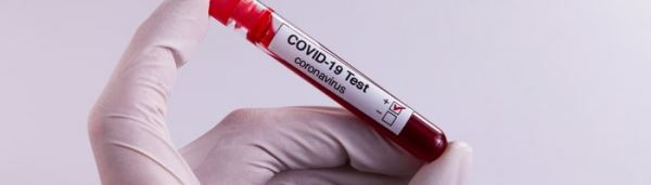 Хеликс начнет выполнять анализ на коронавирус COVID-19